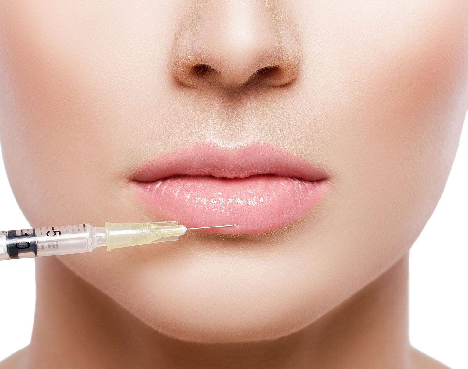 injections, acide hyaluronique, marseille, volume